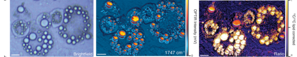 耶鲁大学新进展！探索活细胞脂肪代谢过程：光学红外显微成像技术揭开DNL的奥秘
