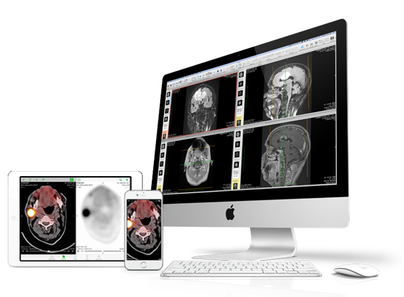 OsiriX MD医疗图像处理软件12.0版本已正式发布