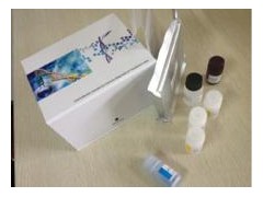 CAM-ab试剂盒,人抗钙调素特异抗体ELISA试剂盒