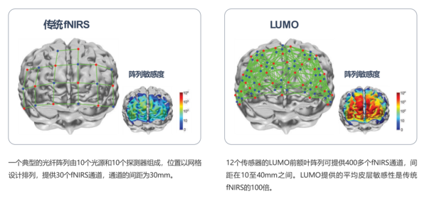 英国UCL可穿戴高密度脑成像系统